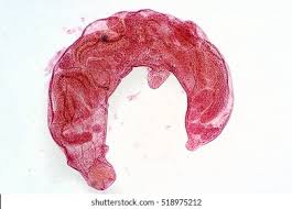 Sporocyst