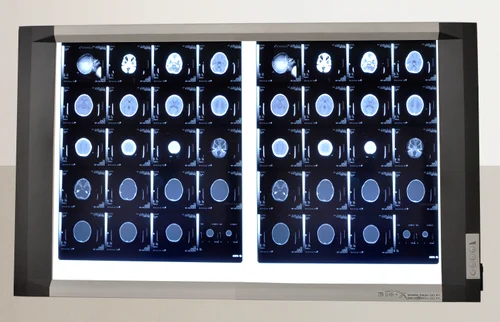 X-Ray View- MRI View box