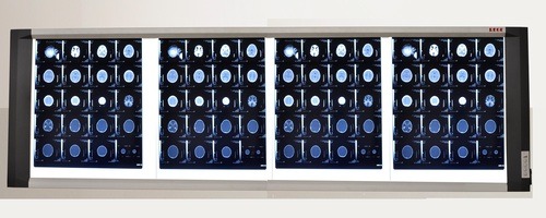 X- Ray View Box (4 In 1)